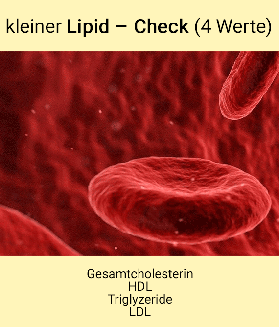 kleiner Lipid – Check
