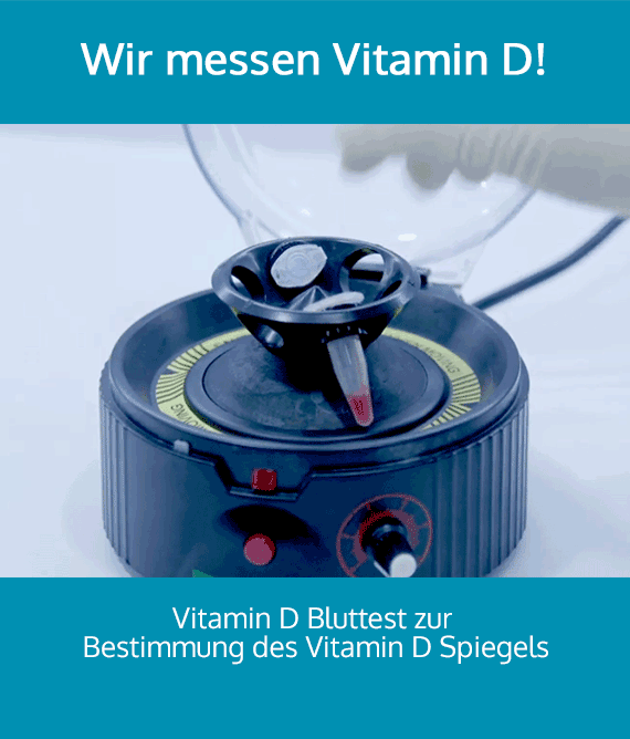 Vitamin D Messung